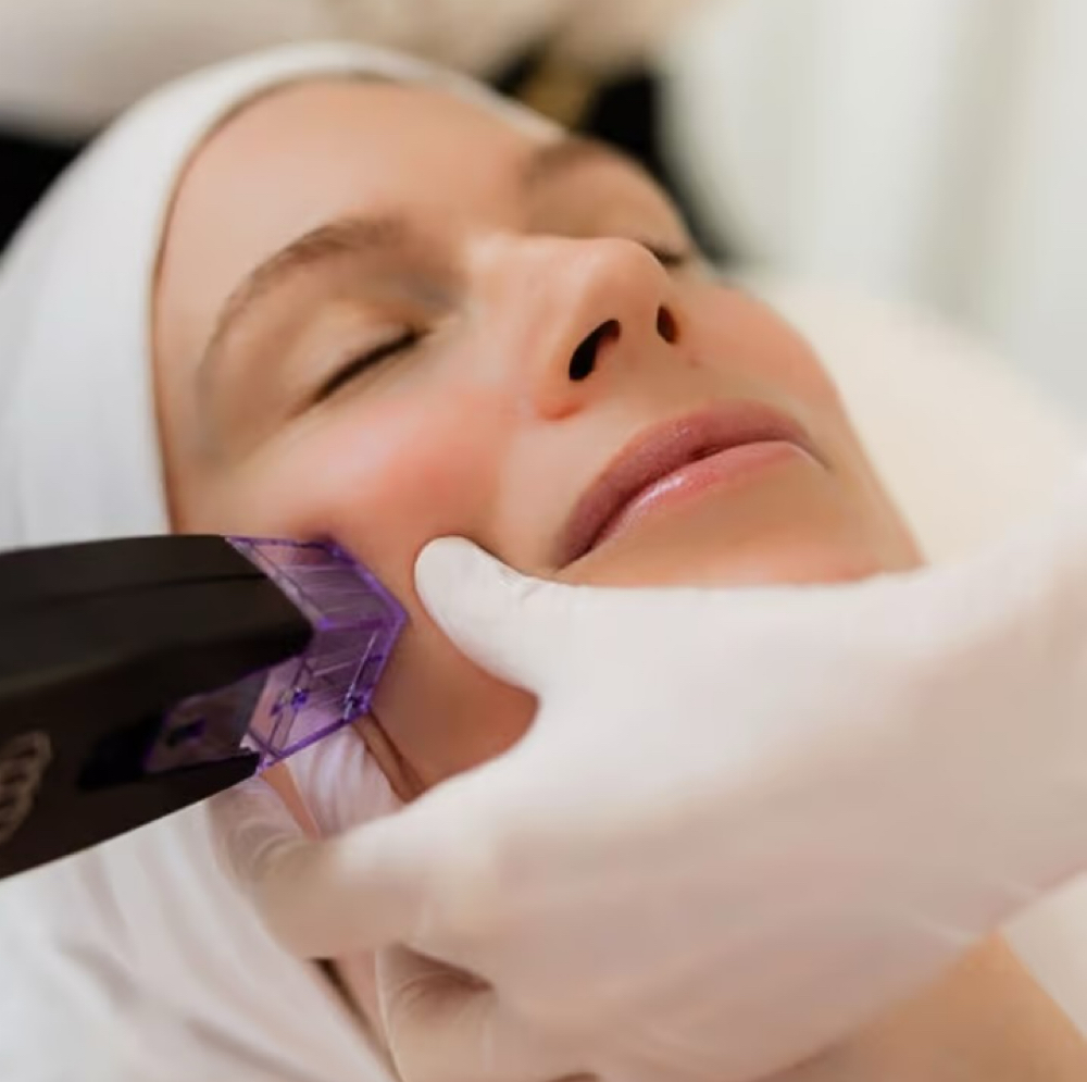 Morpheus Full Facial Which Exosomes at SiempreBellasBeautySpa in North Miami, FL