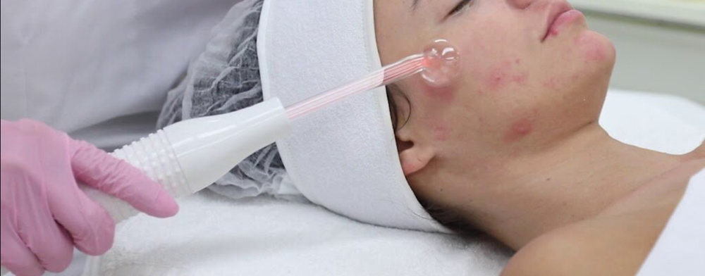 Acne Facial at Ultimate Skin Care in Flanders, NJ