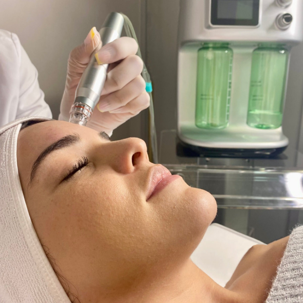 Hydradermabrasion at Pink Paradise Esthetics LLC in Mobile, AL