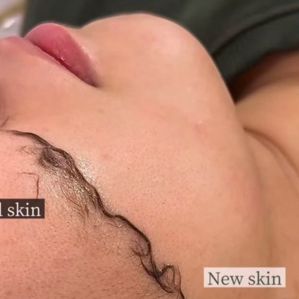 Facial+Dermaplaning at Gigi’s Beauté LLC in Lanham, MD