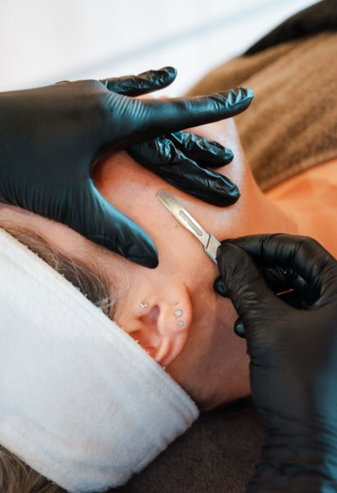 Express Dermaplaning
