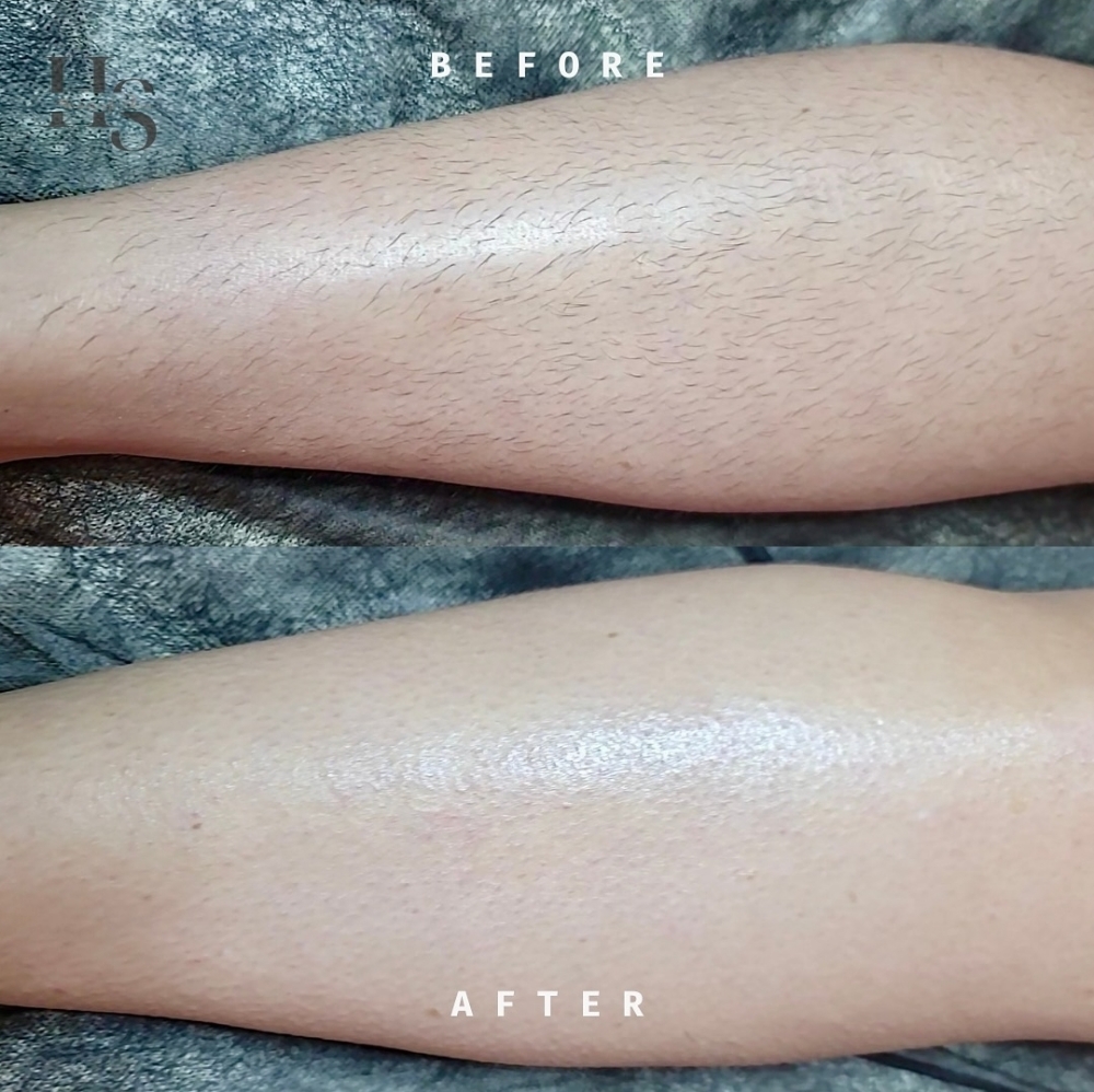 Full Leg Wax at Haus Of Skin in Burleson, TX
