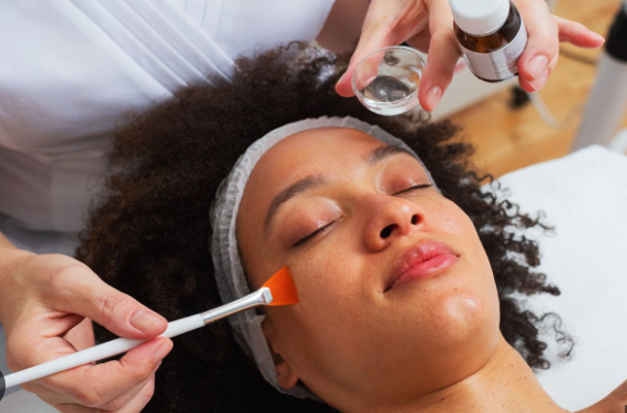 Chemical Exfoliation Treatment