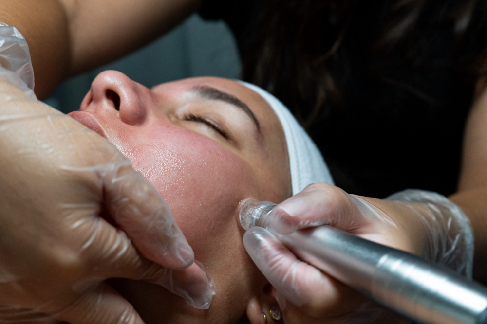 Hydro-Dermabrasion Facial