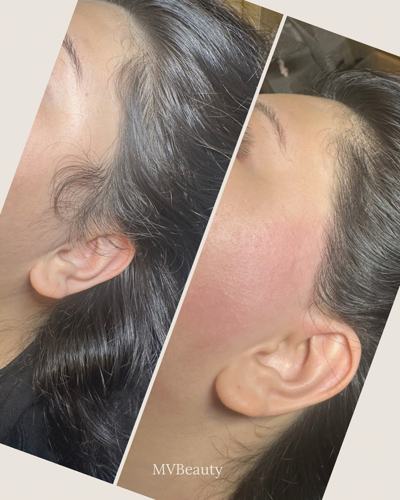 Side Burns at MV Beauty in Broken Arrow, OK