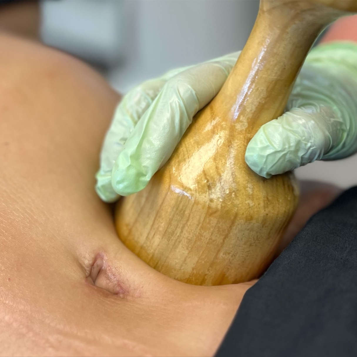 Wood Therapy at Aesthetic Healing Massage in Minneapolis, MN