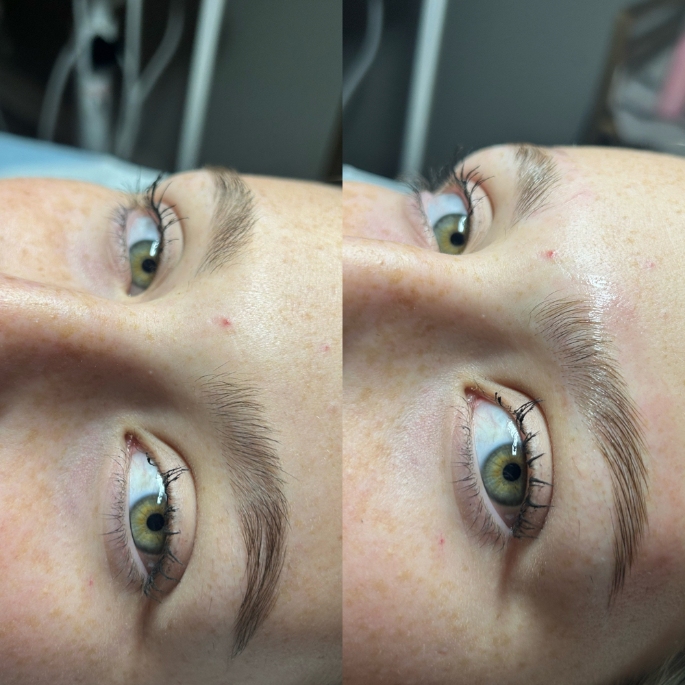 Brow Lamination