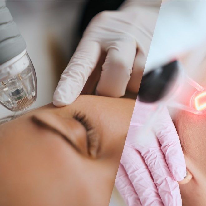 Wrinkle, Scar Resurface&Microneedle at Zen Beauty in McAllen, TX