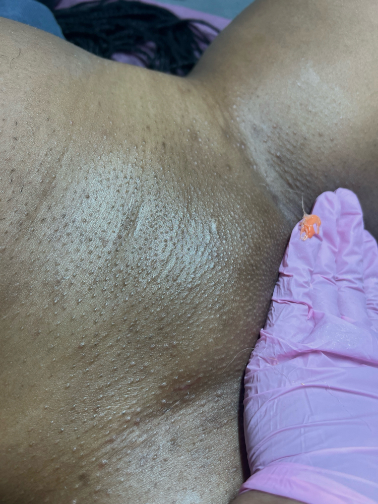 bikini line wax