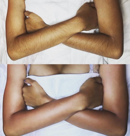 Full Arm (Female)