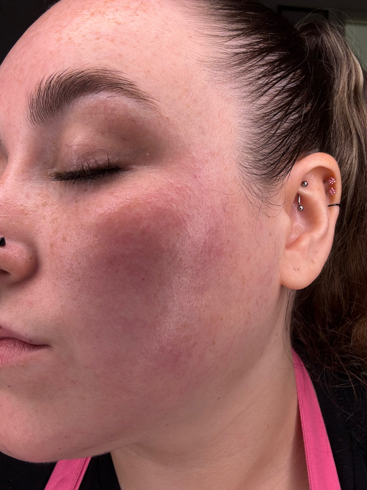 The Age Rewind Facial ( Age Define)