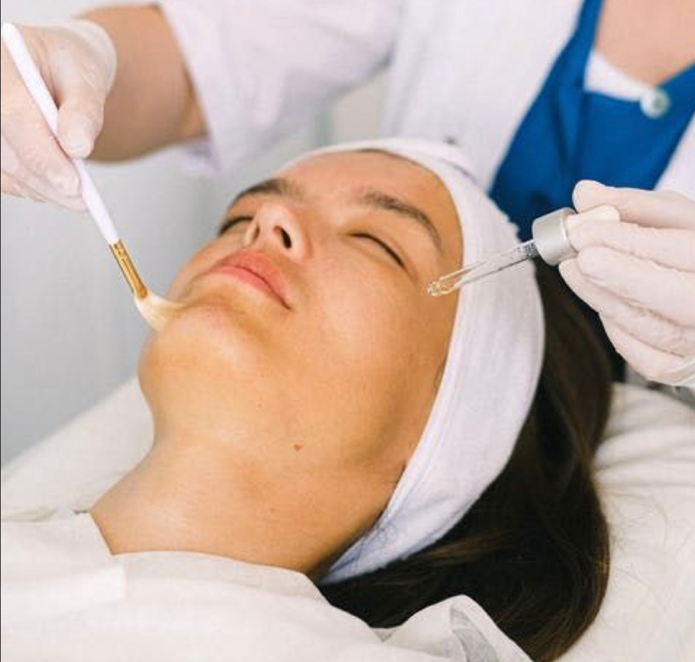 Pro Jessner's Peel