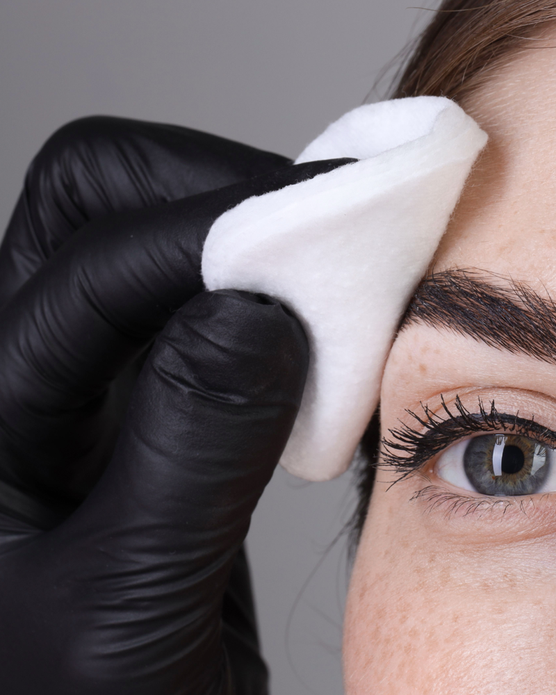 Brow Consultation