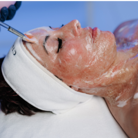 Beyond Botox Facial at LMK ESTHETICS SKINCARE SPA in Lake Ozark, MO