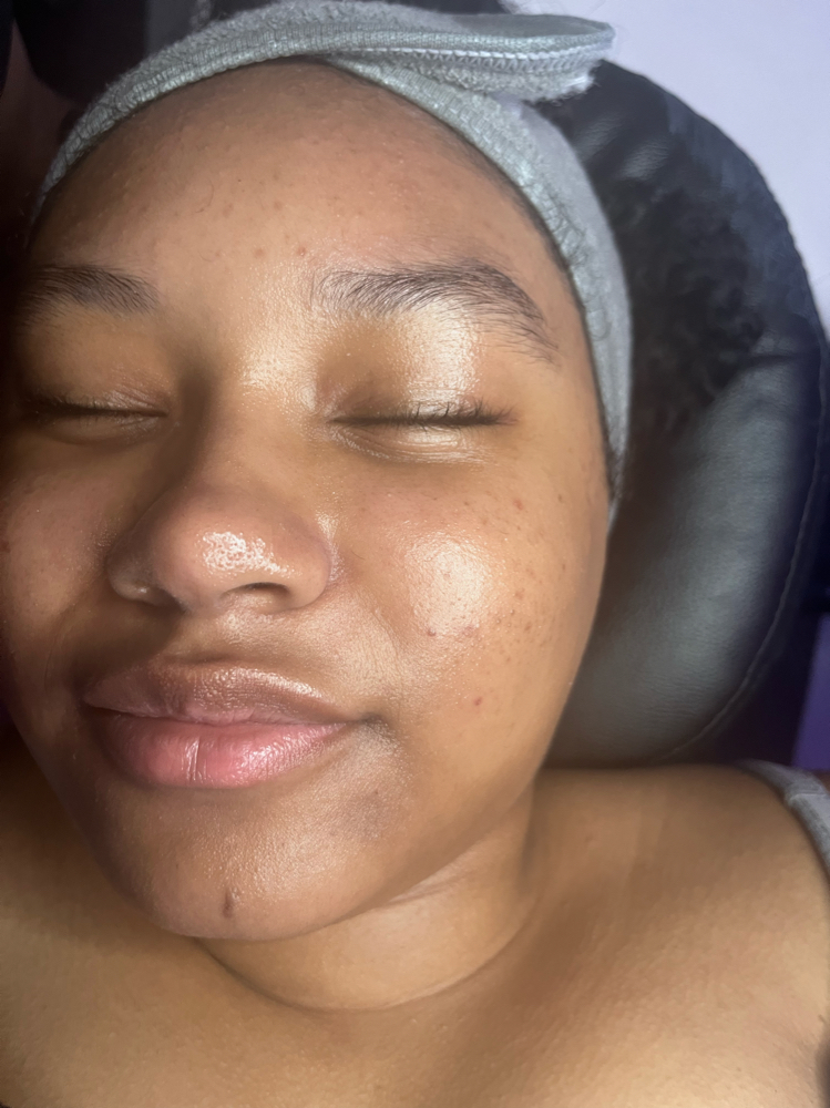 Teen Dermaplaning+Gold Glow Facial