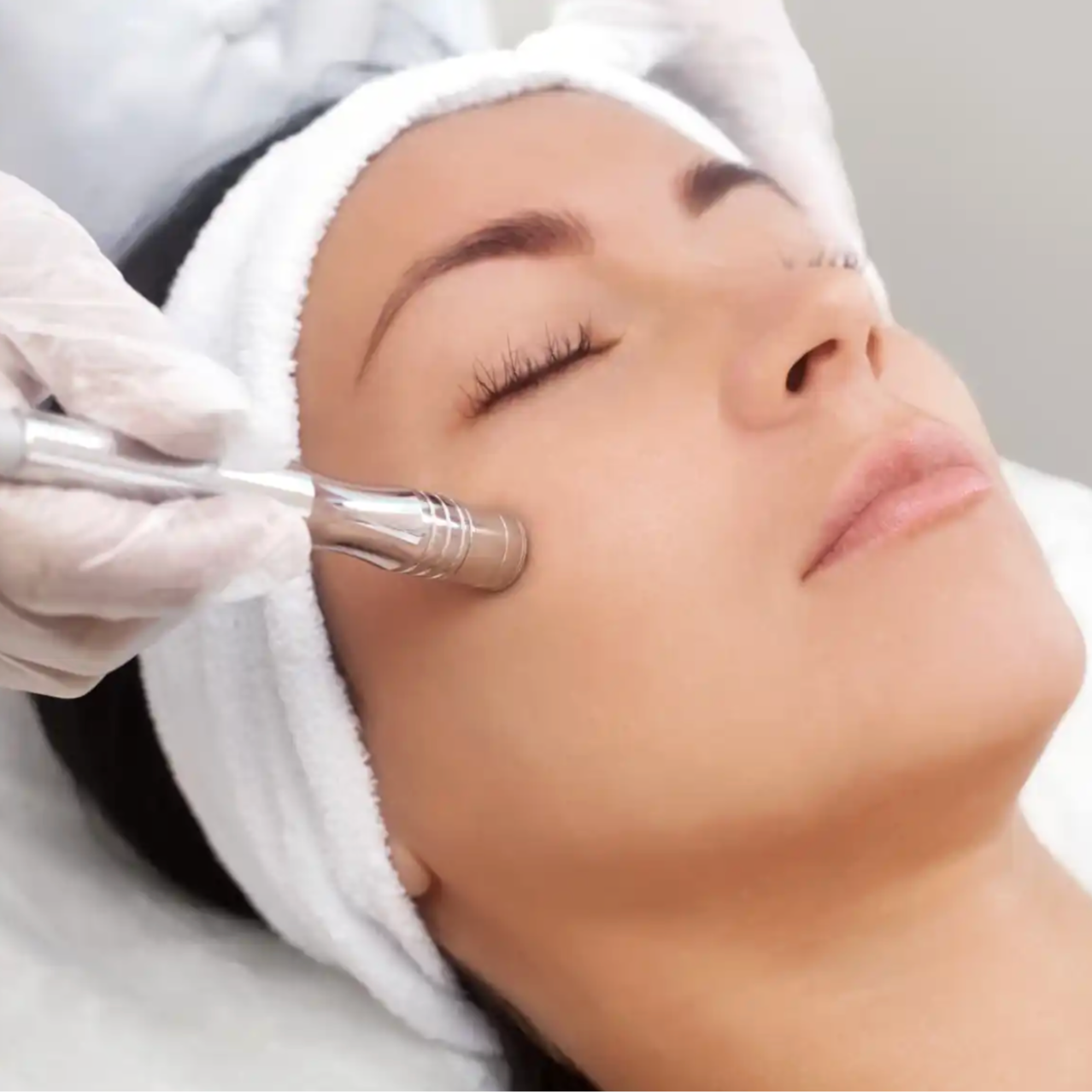 SALE Diamond Microdermabrasion
