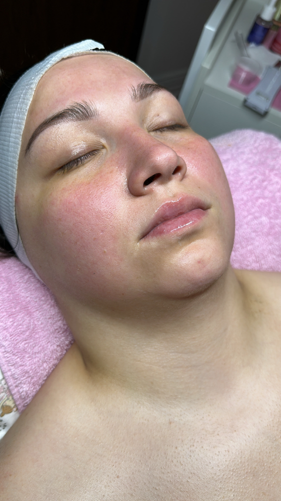 Gracielu Facial