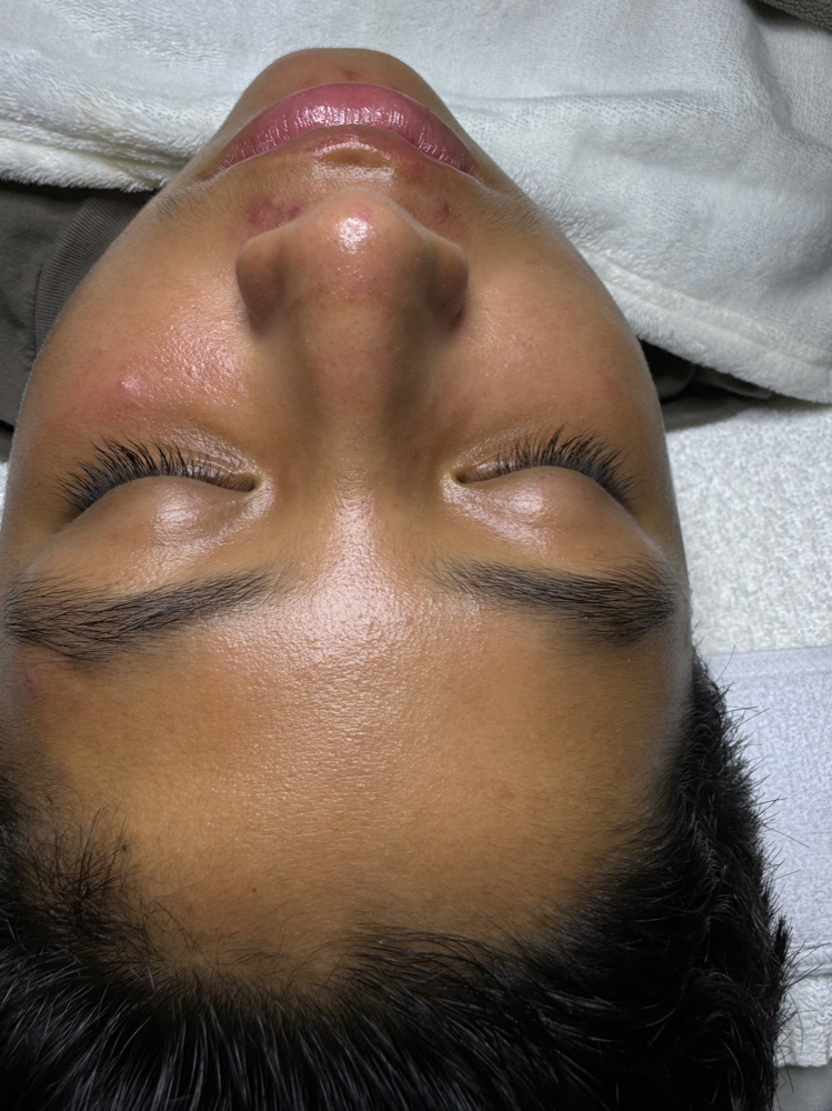 Teen Facial