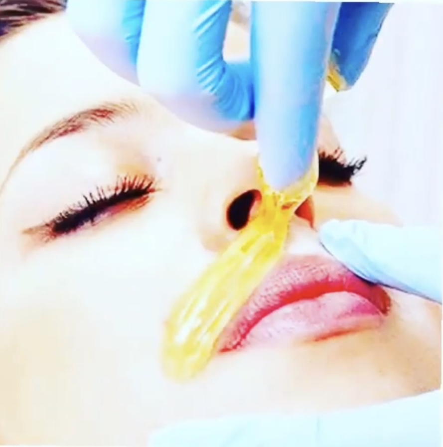 Sugaring/Waxing- Lip or Chin