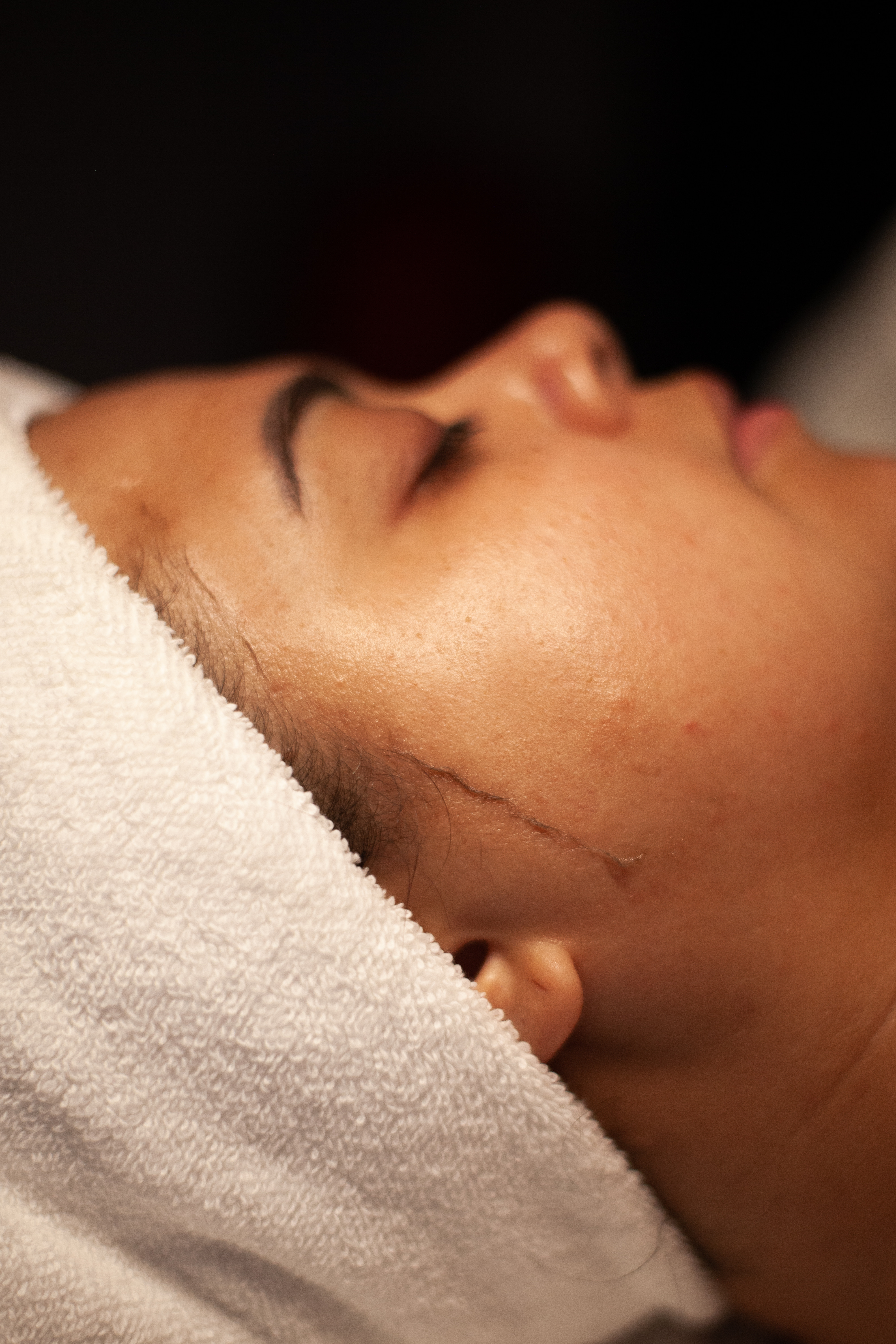 Glow & Go Dermaplaning Package (5)