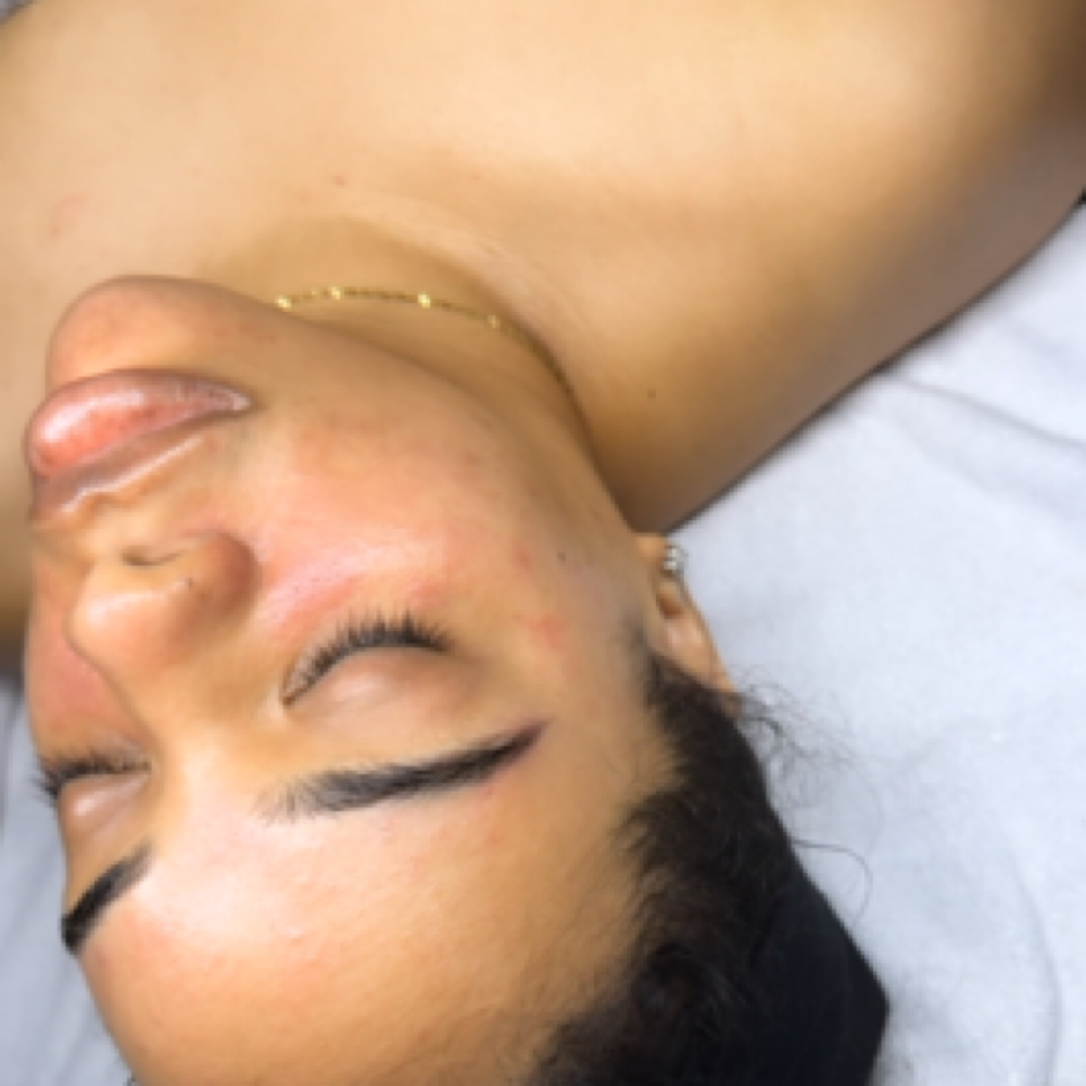 DeLuxe Power Facial at Luxe Beauty Aesthetics in Loganville, GA
