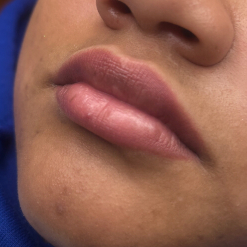 Lip Neuralizaton at Dreambrowsbykelli in Niagara Falls, NY