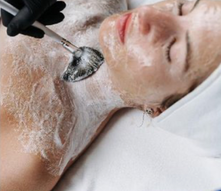 Chemical Peels at Go And Glow Esthetics in Merrick, NY