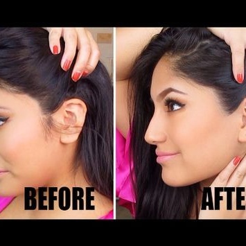 Sideburn Hair Removal (Wax)