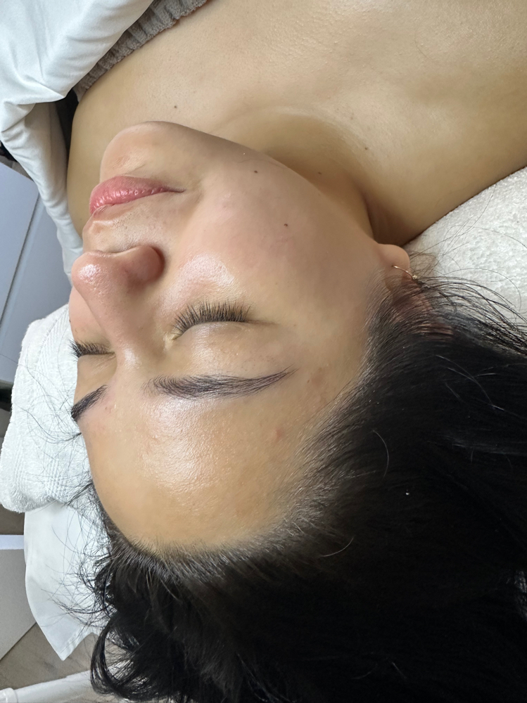 Dermaplane September Promo