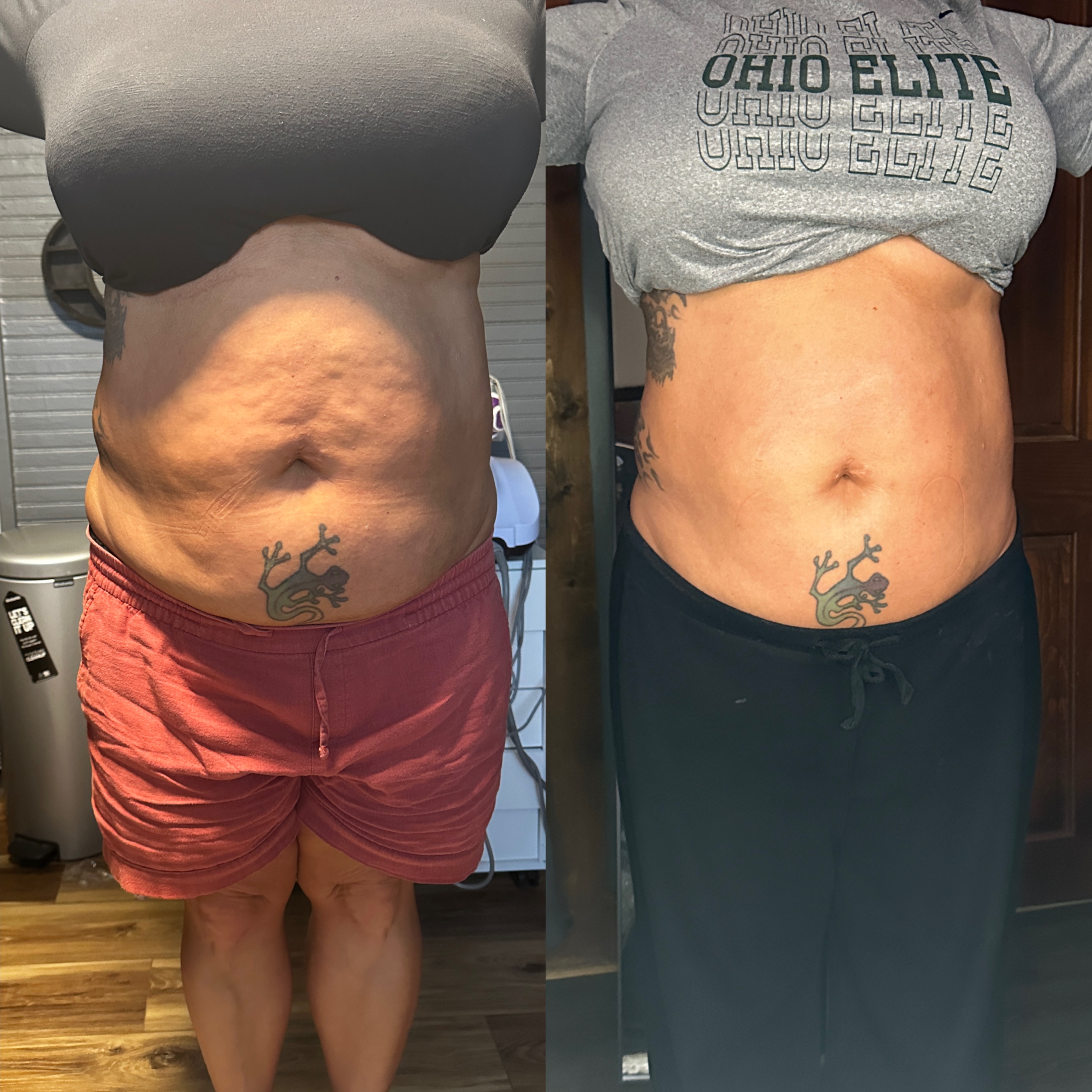 Body Sculpting Consult