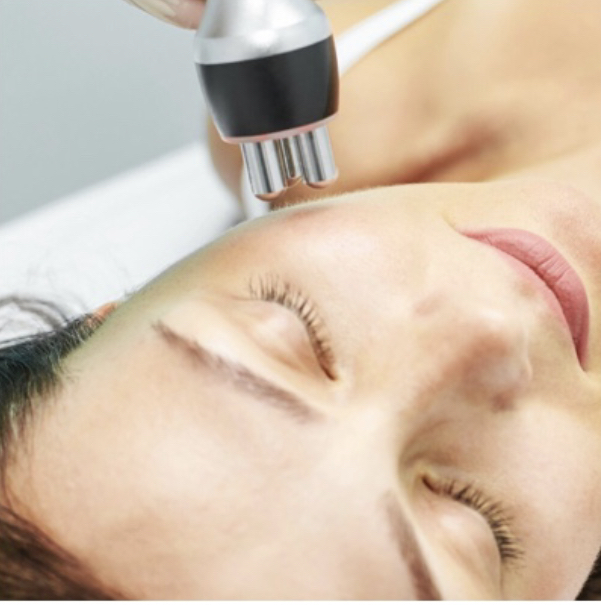 Skin Tightening (RF) Facial