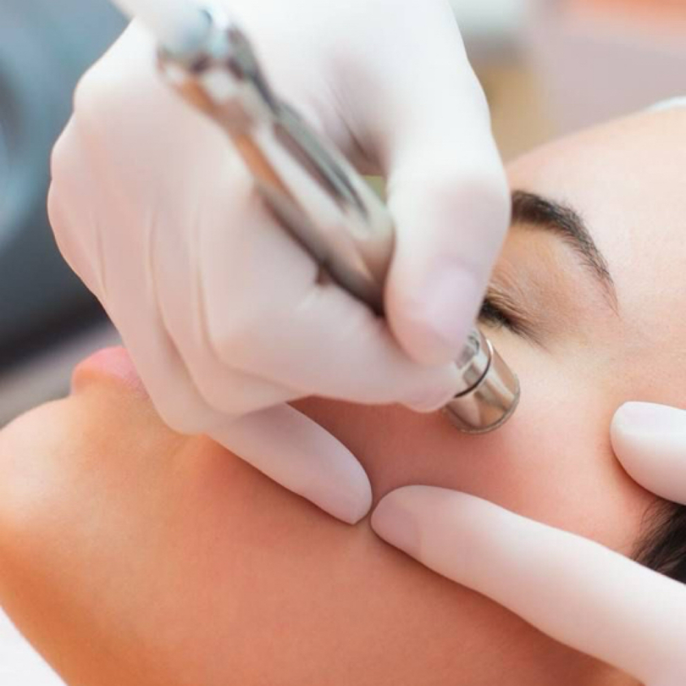 Diamond Glow Facial at Nude Skin Aesthetics in San Pedro, CA