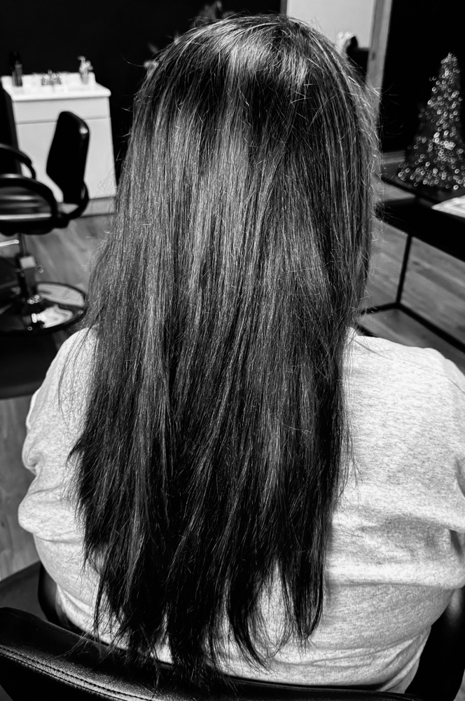 Scalp Treatment