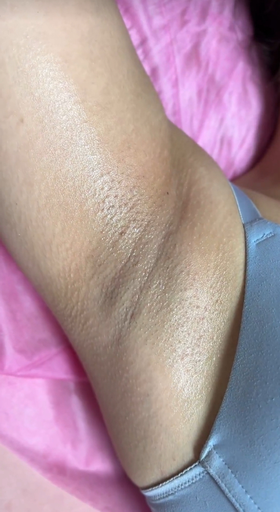 Underarm Wax