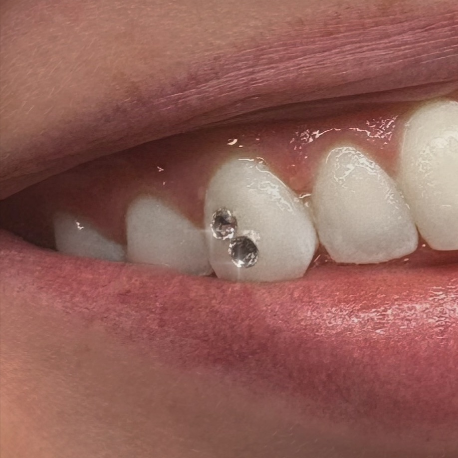 Tooth Gem (2+ Crystals)