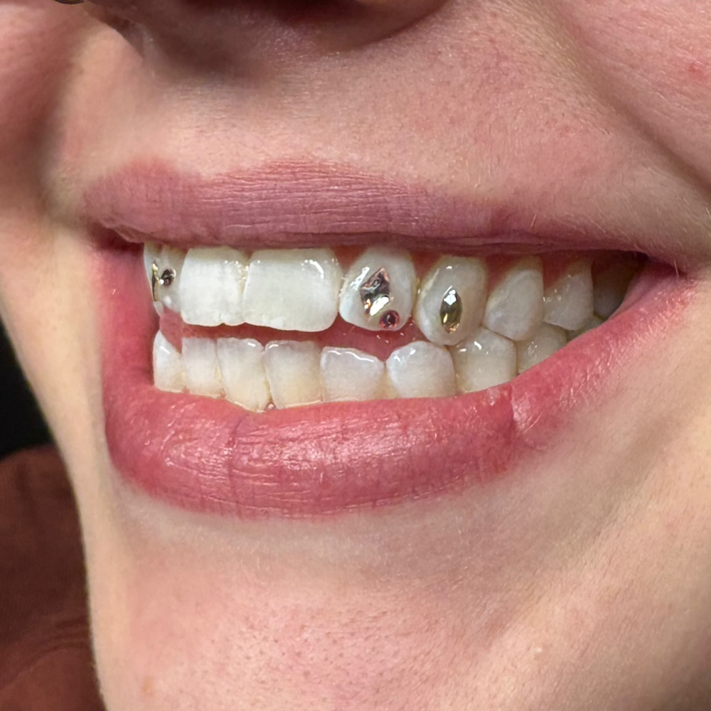 Tooth Gem (2+ Crystals)