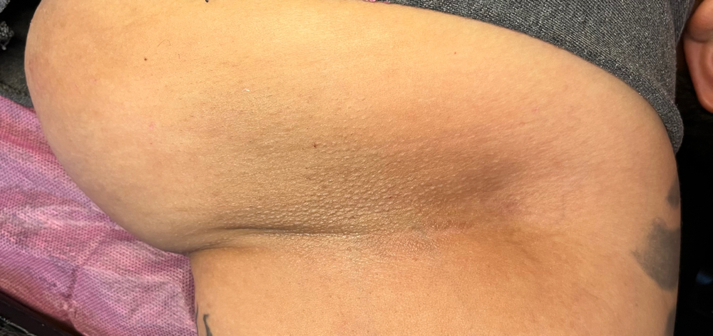 Underarms at A.Rose Beauty in San Antonio, TX