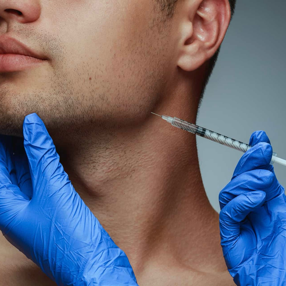 Masseter | TMJ Tox