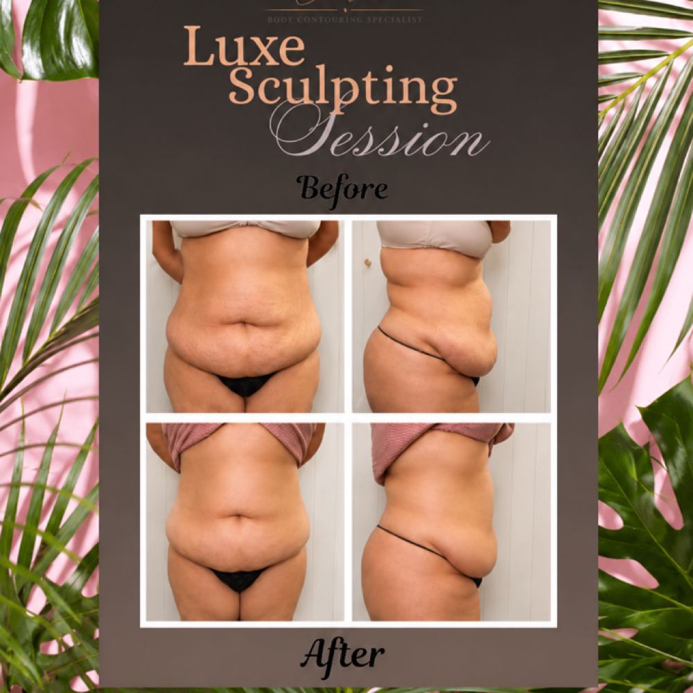 Luxe Sculpting Session at Luxe Contour in Ontario, CA