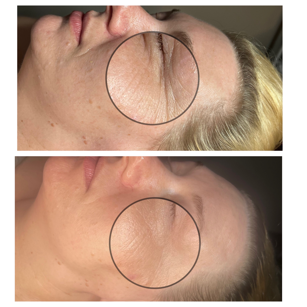 Fire & Ice Facial