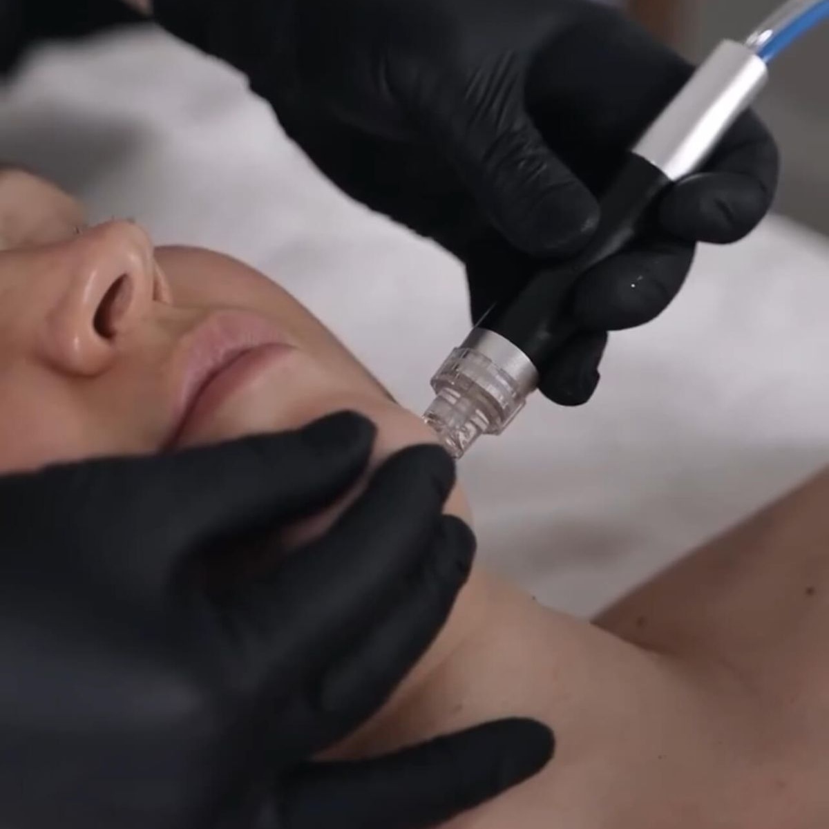 Deluxe Hydro Facial at Jennifer Marie Skincare in Elkhart, IN