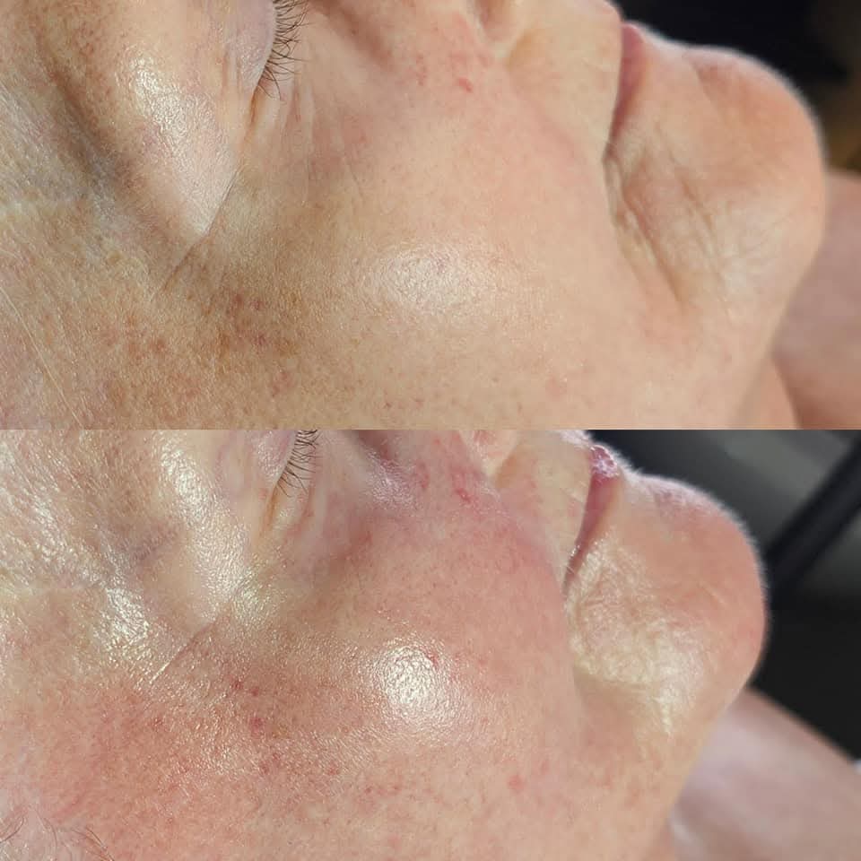 Advanced Skin Rejuvenating Facial