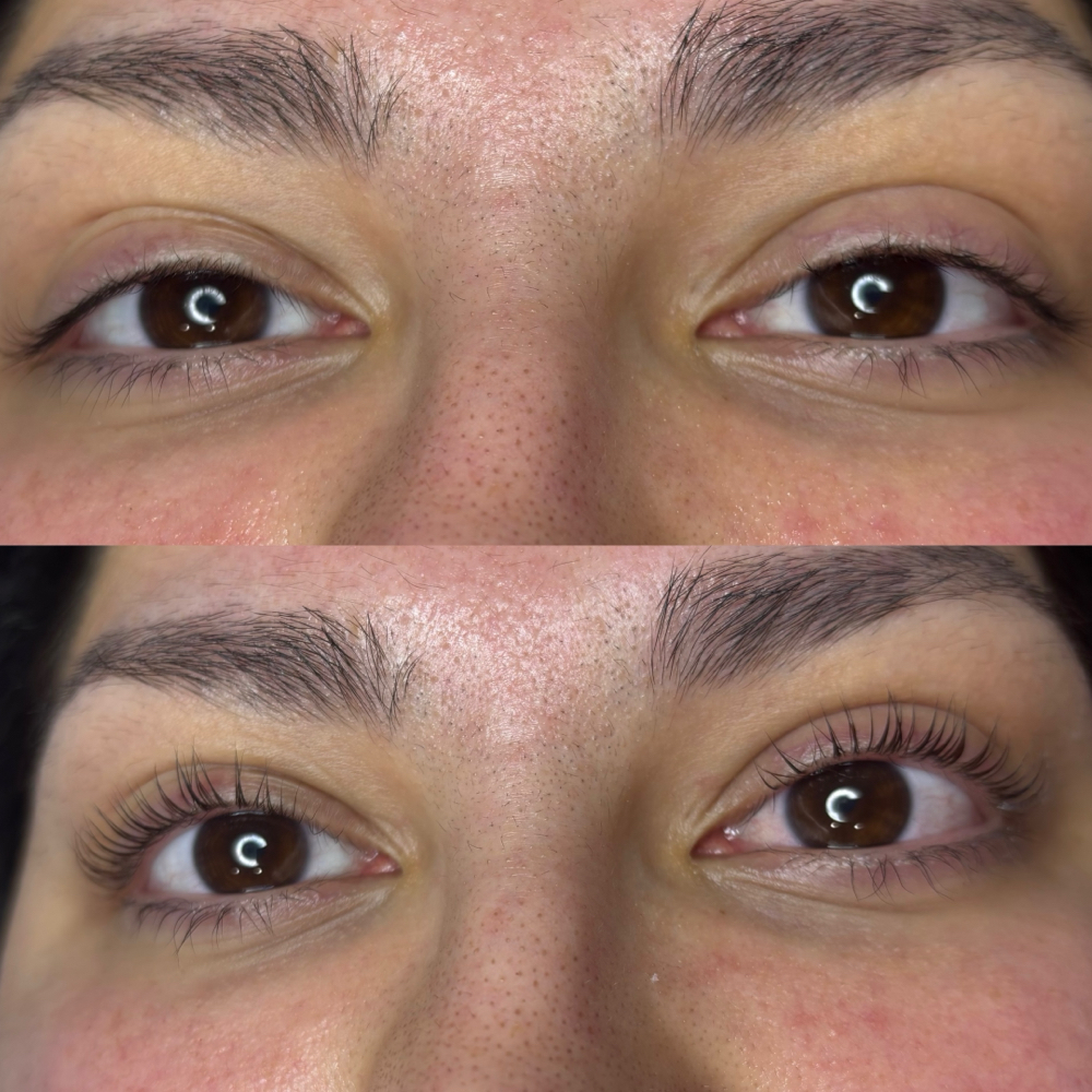 Lash Lift