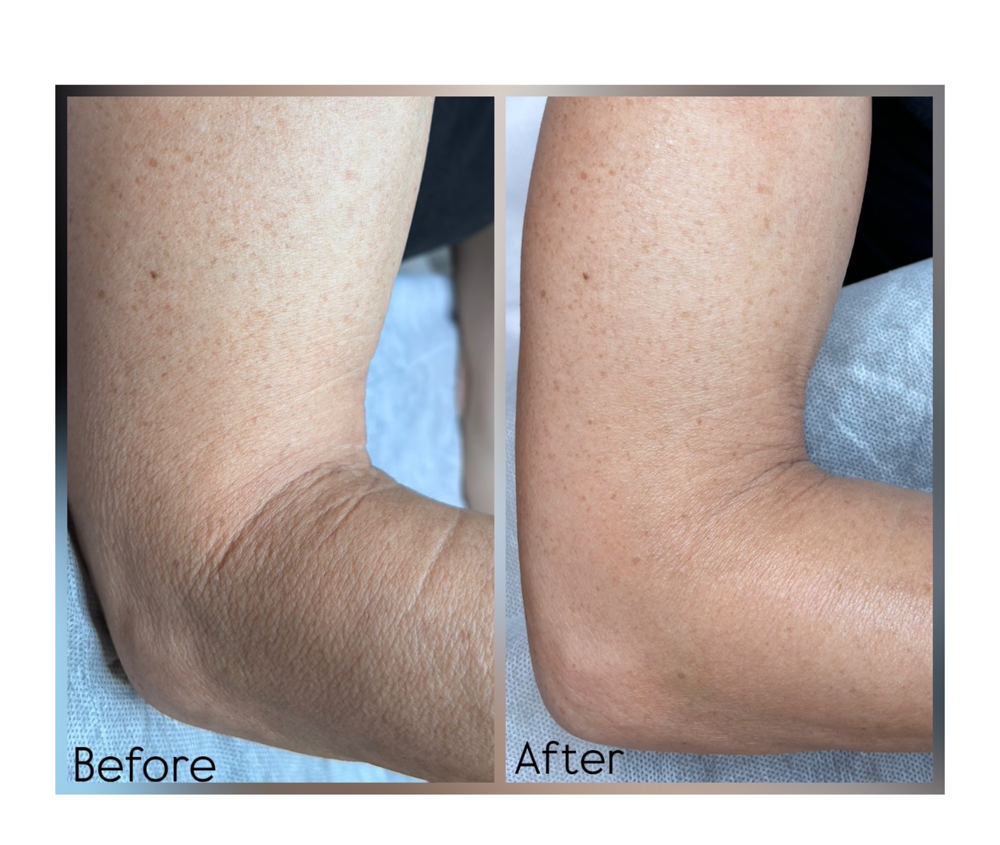 Body Rejuvenation