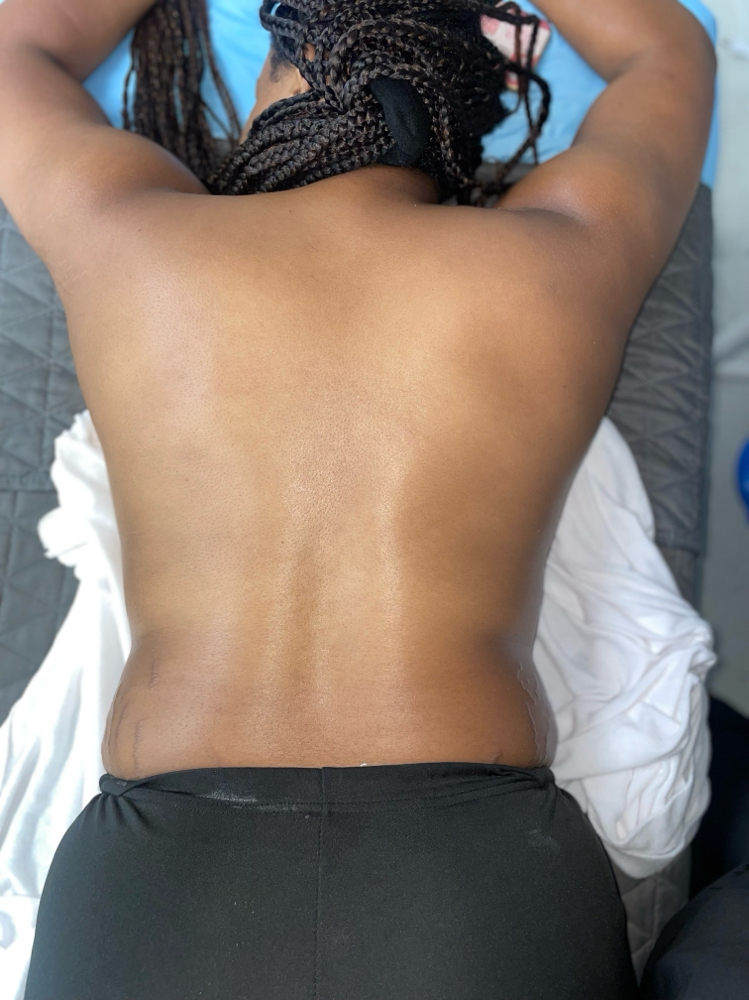 Back Facial