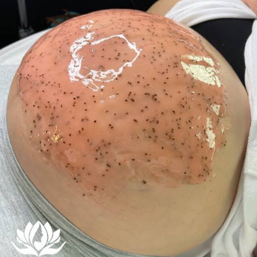 Mama Moon Belly Facial at Ethereal Aesthetics By Rachel in Redlands, CA