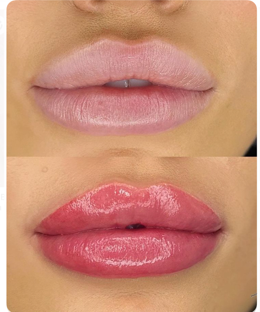 Lip Blushing