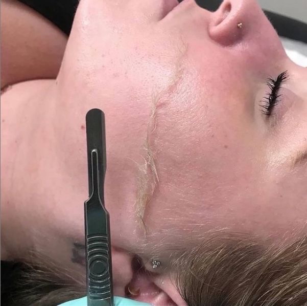 Dermaplane Skin Facial
