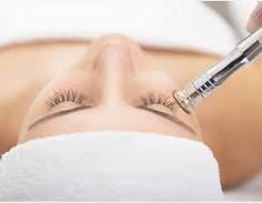 Add On Microdermabrasion