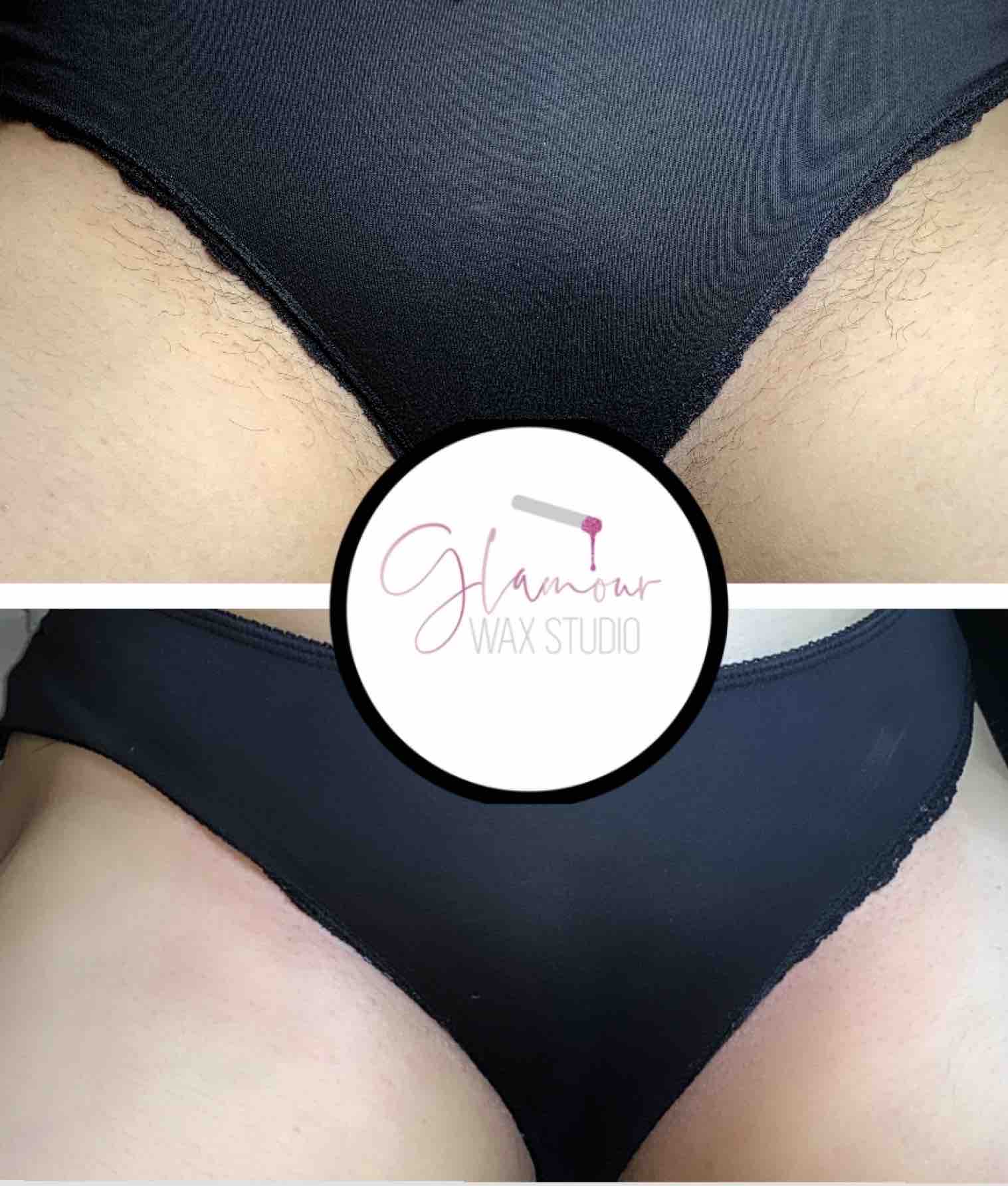 Bikini Line
